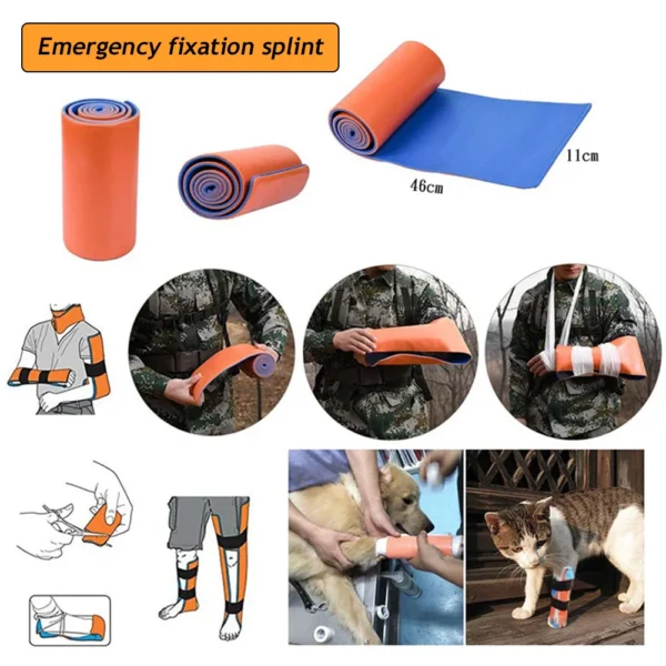 Universal Aluminum Splint Roll - Image 6